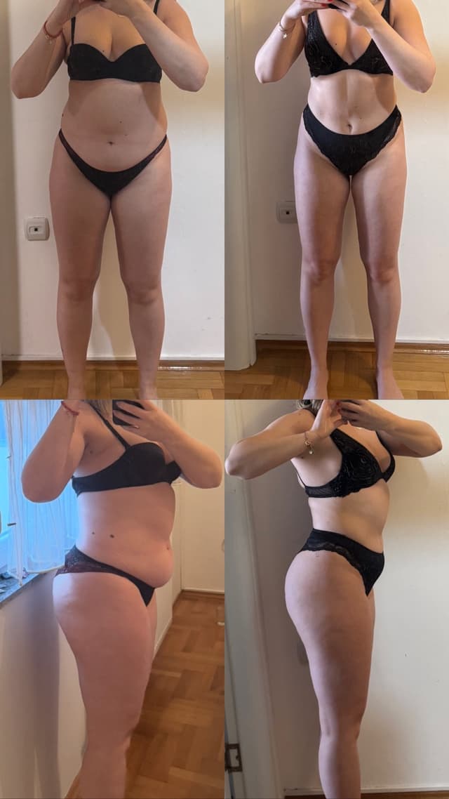 Transformacija 10